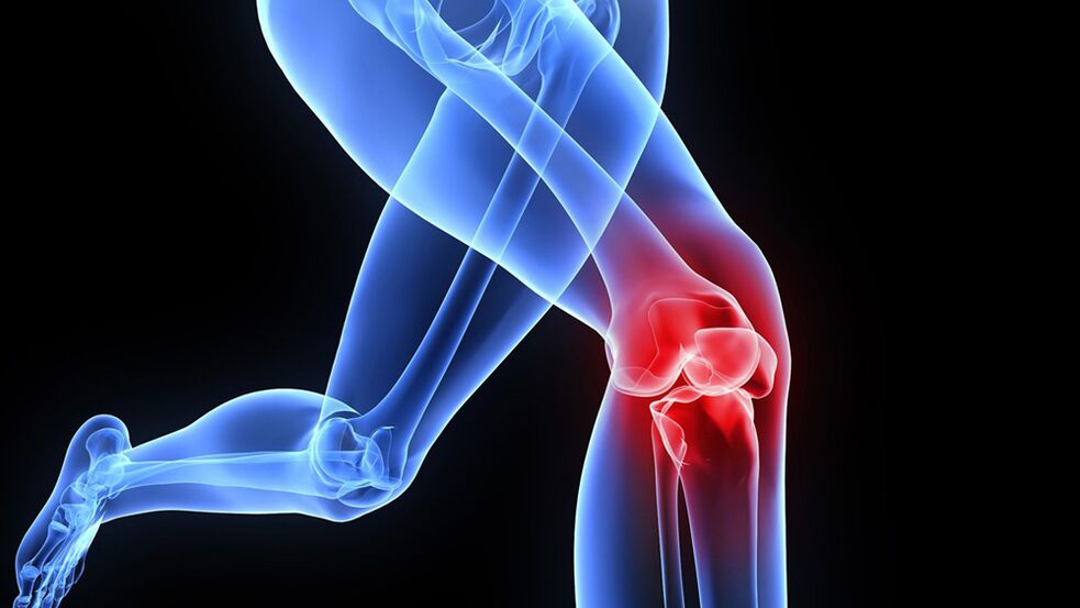 probleme cu genunchii din cauza artrozei